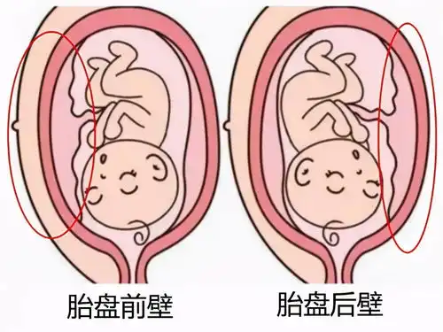 怀孕后是胎盘前壁好还是后壁好,你怎么看